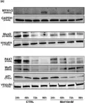 Fig.4.A showing Western Blotting in a Mus musculus (House mouse) sample from the publication: Metformin regulates myoblast differentiation through an AMPK-dependent mechanism.