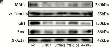 Fig.3.E showing Western Blotting from the publication: TTBK2-Driven Ciliogenesis Is Required for Intrinsic Neuronal Regeneration After Spinal Cord Injury.