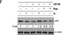 Fig.5.F showing Western Blotting from the publication: mTORC1/ERK1/2 Interplay Regulates Protein Synthesis and Survival in Acute Myeloid Leukemia Cell Lines.