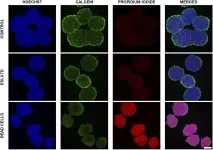 Fig.1.A showing Immunohistochemistry-immunofluorescence in a Homo sapiens (Human) sample from the publication: Improved contractile potential in detrusor microtissues from pediatric patients with end stage lower urinary tract dysfunction.