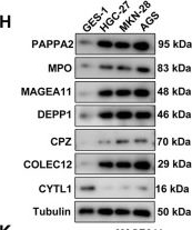 Fig.9.H showing Western Blotting in a Homo sapiens (Human) sample from the publication: Unveiling DNA damage repair-based molecular subtypes, tumor microenvironment and pharmacogenomic landscape in gastric cancer.