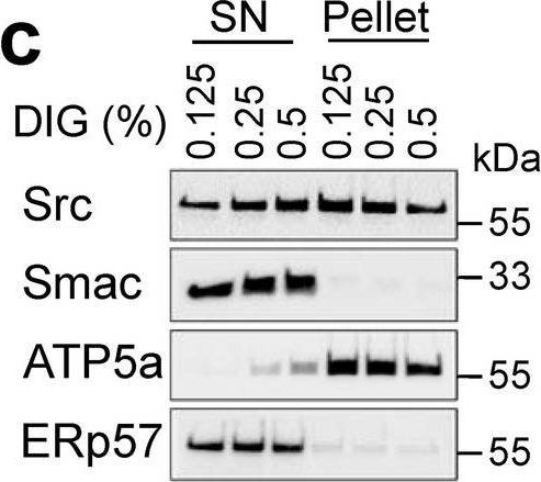 Fig.4.C showing Western Blotting in a Homo sapiens (Human) sample from the publication: Mitochondrial matrix-localized Src kinase regulates mitochondrial morphology.