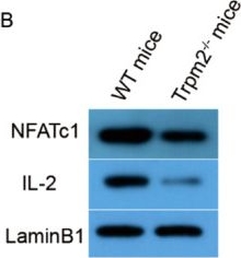 Fig.3.B showing Western Blotting from the publication: TRPM2 Deficiency Attenuates Allergic Rhinitis-Like Inflammation With Altered Ca2+-NFAT Signaling, Treg Responses, and sIgE Production.