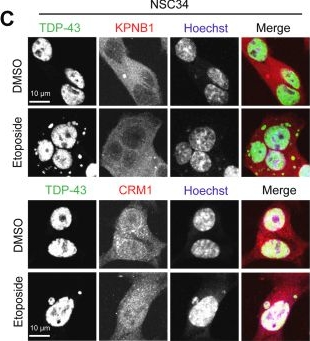 Fig.9.C showing Immunocytochemistry-immunofluorescence from the publication: Regulation of TAR DNA binding protein 43 (TDP-43) homeostasis by cytosolic DNA accumulation.