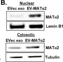 Fig.2.B showing Western Blotting from the publication: A novel role of secreted methionine adenosyltransferase α2 in colorectal liver metastases.