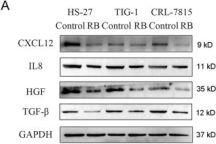 IL-8 (E5F5Q) XP® Rabbit mAb | Cell Signaling Technology
