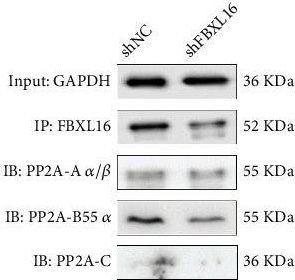 Fig.4.C showing Western Blotting in a Homo sapiens (Human) sample from the publication: FBXL16 Promotes Endometrial Progesterone Resistance via PP2AB55α /Cyclin D1 Axis in Ishikawa.