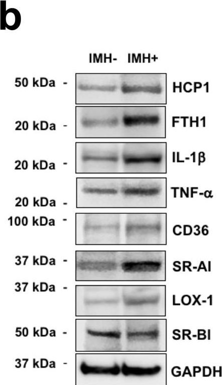 Fig.8.B showing Western Blotting from the publication: Intramyocardial hemorrhage drives fatty degeneration of infarcted myocardium.
