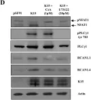 Fig.4.D showing Western Blotting from the publication: Kaposi's sarcoma herpesvirus K15 protein contributes to virus-induced angiogenesis by recruiting PLCγ1 and activating NFAT1-dependent RCAN1 expression.
