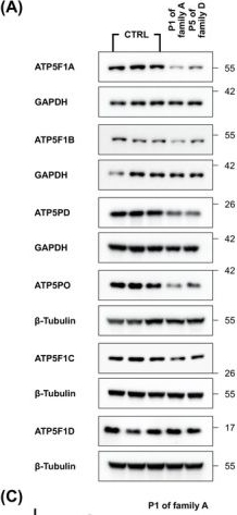 Fig.3.A showing Western Blotting in a Homo sapiens (Human) sample from the publication: Expanding the Allelic and Clinical Heterogeneity of Movement Disorders Linked to Defects of Mitochondrial Adenosine Triphosphate Synthase.