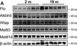 Fig.2.A showing Western Blotting in a Mus musculus (House mouse) sample from the publication: The m6A Demethylase Fto Enhances Susceptibility to Atrial Fibrillation by Demethylating Kcne1 in Aging Mice.