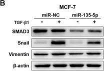 Fig.3.B showing Western Blotting in a Homo sapiens (Human) sample from the publication: MiR-135-5p inhibits TGF-β-induced epithelial-mesenchymal transition and metastasis by targeting SMAD3 in breast cancer.