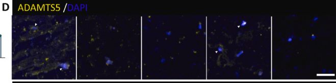 Fig.7.D showing Immunohistochemistry-immunofluorescence from the publication: Restoring disc matrix homeostasis: Dual-miRNA and human platelet lysate as a novel therapeutic strategy.