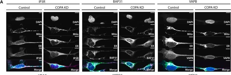Fig.5.A showing Immunocytochemistry-immunofluorescence in a Hippocampus (Seahorse) sample from the publication: COPI-regulated mitochondria-ER contact site formation maintains axonal integrity.
