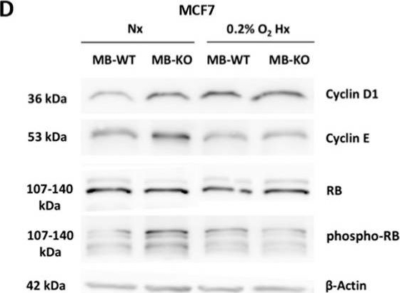 Fig.1.D showing Western Blotting in a Homo sapiens (Human) sample from the publication: Pro-Apoptotic and Anti-Invasive Properties Underscore the Tumor-Suppressing Impact of Myoglobin on a Subset of Human Breast Cancer Cells.