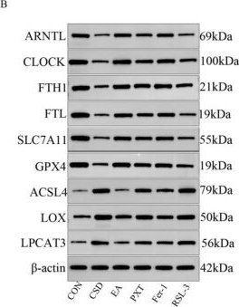 Fig.9.B showing Western Blotting from the publication: Mechanistic study on electroacupuncture-regulated circadian autophagy for inhibiting ferroptosis in hippocampal neurons and alleviating depression-like behaviors in adulthood induced by early chronic sleep deprivation.