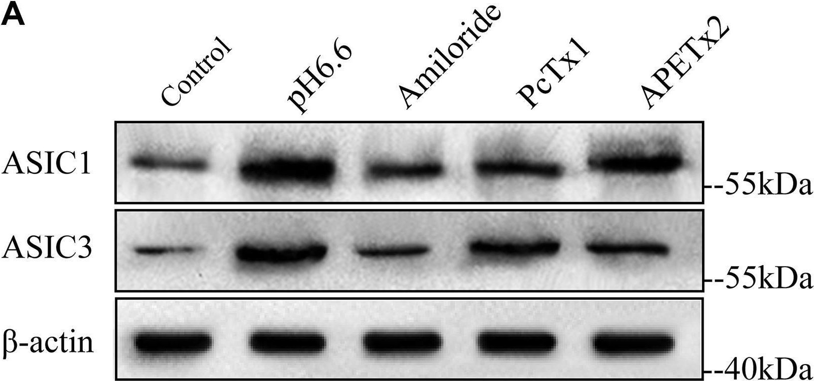 Fig.3.A showing Western Blotting in a Homo sapiens (Human) sample from the publication: ASIC1 and ASIC3 mediate cellular senescence of human nucleus pulposus mesenchymal stem cells during intervertebral disc degeneration.
