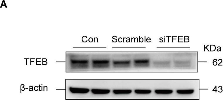 Fig.2.A showing Western Blotting from the publication: Role of Transcription Factor EB in Mitochondrial Dysfunction of Cisplatin-Induced Acute Kidney Injury.