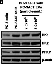 Fig.4.B showing Western Blotting from the publication: Metabolic Reprogramming Into a Glycolysis Phenotype Induced by Extracellular Vesicles Derived From Prostate Cancer Cells.