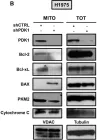 Fig.5.B showing Western Blotting from the publication: Non-Canonical Role of PDK1 as a Negative Regulator of Apoptosis through Macromolecular Complexes Assembly at the ER-Mitochondria Interface in Oncogene-Driven NSCLC.