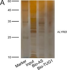 Fig.4.A showing Western Blotting from the publication: Long noncoding RNA TUG1 promotes chondrosarcoma progression and M2 polarization.