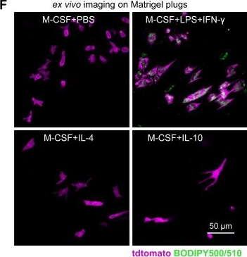 Fig.1.F from the publication: Intravital lipid droplet labeling and imaging reveals the phenotypes and functions of individual macrophages in vivo.