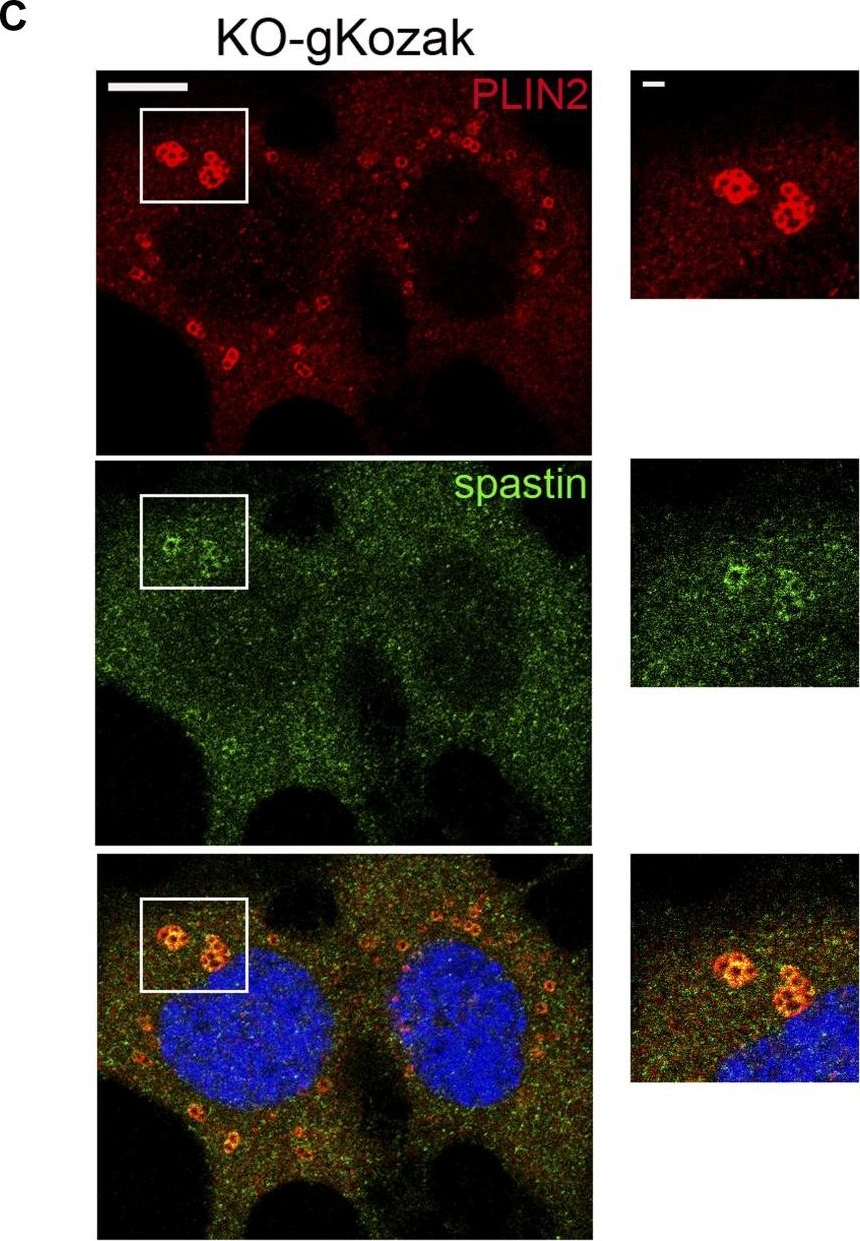 Microtubule-dependent and independent roles of spastin in lipid droplet dispersion and biogenesis.