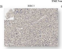 Fig.1.B showing Immunohistochemistry from the publication: BIRC3/CAV1 co-expression drives GBM aggressiveness as a prognostic signature and therapeutic vulnerability.