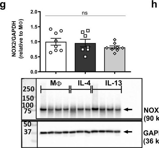 Fig.4.G showing Western Blotting from the publication: IL-4 and IL-13 induce equivalent expression of traditional M2 markers and modulation of reactive oxygen species in human macrophages.