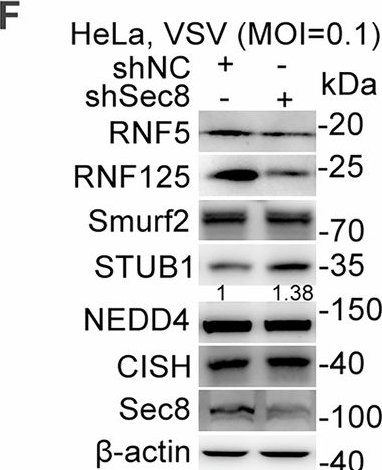 Fig.3.F showing Western Blotting in a Mus musculus (House mouse) sample from the publication: Sec8: a novel positive regulator of RIG-I in anti-RNA viral defense.