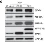 Fig.2.D showing Western Blotting from the publication: EPS8 phosphorylation by Src modulates its oncogenic functions.