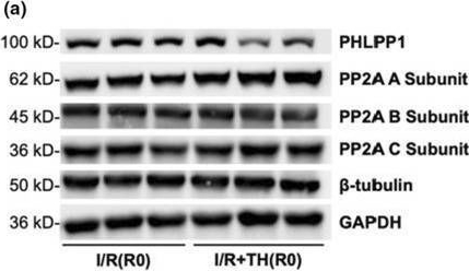 Fig.3.A showing Western Blotting from the publication: Intra-ischemic hypothermia cardioprotection involves modulation of PTEN/Akt/ERK signaling and fatty acid oxidation.