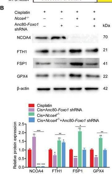 Fig.8.B showing Western Blotting from the publication: FOXO1-NCOA4 Axis Contributes to Cisplatin-Induced Cochlea Spiral Ganglion Neuron Ferroptosis via Ferritinophagy.