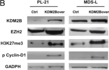 Fig.3.B showing Western Blotting in a Homo sapiens (Human) sample from the publication: The KDM2B- let-7b -EZH2 axis in myelodysplastic syndromes as a target for combined epigenetic therapy.