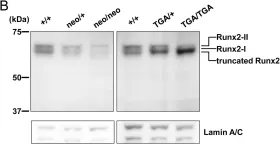 Fig.5.B showing Western Blotting from the publication: Runx2-I isoform contributes to fetal bone formation even in the absence of specific N-terminal amino acids.