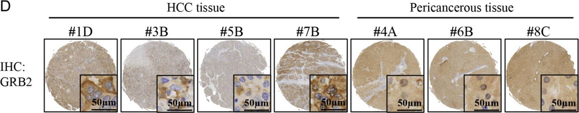 Fig.4.D showing Immunohistochemistry from the publication: Bufalin inhibits hepatocellular carcinoma progression by blocking EGFR-mediated RAS-RAF-MEK-ERK pathway activation.