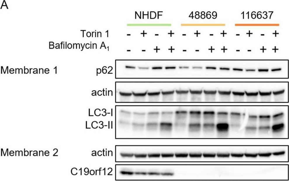 Identification of Autophagy as a Functional Target Suitable for the Pharmacological Treatment of Mitochondrial Membrane Protein-Associated Neurodegeneration (MPAN) In Vitro.