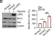 Fig.1.D showing Western Blotting from the publication: LRP5 Regulates HIF-1α Stability via Interaction with PHD2 in Ischemic Myocardium.