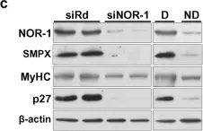 Fig.5.C showing Western Blotting in a Homo sapiens (Human) sample from the publication: The nuclear receptor NOR-1 regulates the small muscle protein, X-linked (SMPX) and myotube differentiation.
