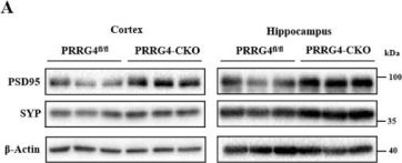 PSD95 (D27E11) XP® Rabbit mAb | Cell Signaling Technology