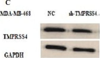 Fig.1.C showing Western Blotting in a Homo sapiens (Human) sample from the publication: Role of TMPRSS4 Modulation in Breast Cancer Cell Proliferation.