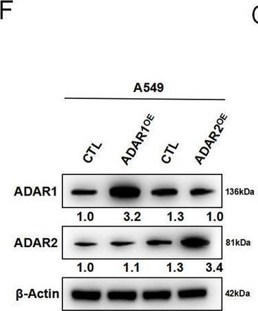 Fig.2.F showing Western Blotting in a Homo sapiens (Human) sample from the publication: A novel mechanism for A-to-I RNA-edited CYP1A1 in promoting cancer progression in NSCLC.