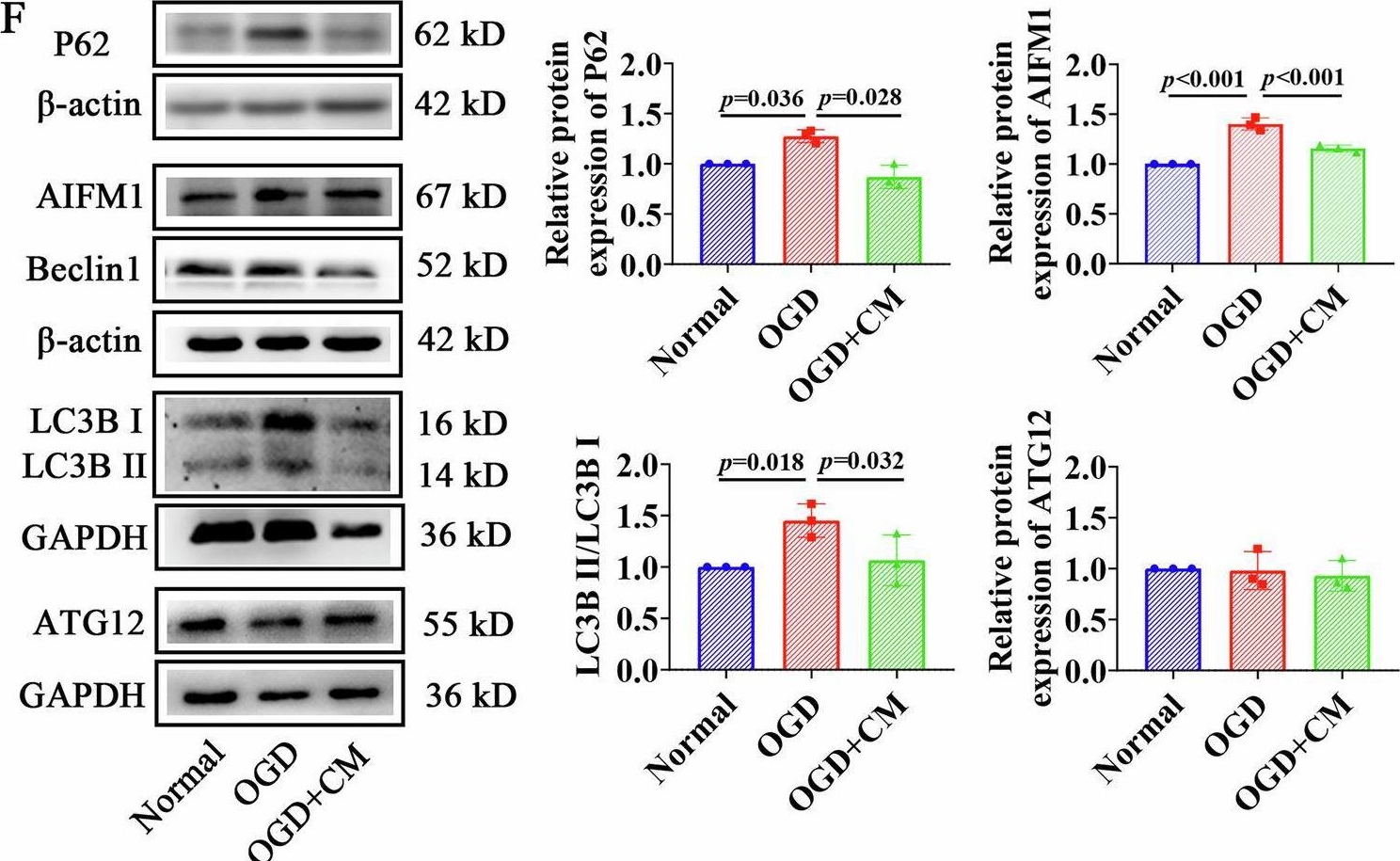 Fig.1.F showing Western Blotting from the publication: Bone marrow mesenchymal stem cells alleviate neurological dysfunction by reducing autophagy damage via downregulation of SYNPO2 in neonatal hypoxic-ischemic encephalopathy rats.