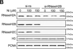 Fig.7.B showing Western Blotting in a Homo sapiens (Human) sample from the publication: Atypical genotoxicity of carcinogenic nickel(II): Linkage to dNTP biosynthesis, DNA-incorporated rNMPs, and impaired repair of TOP1-DNA crosslinks.