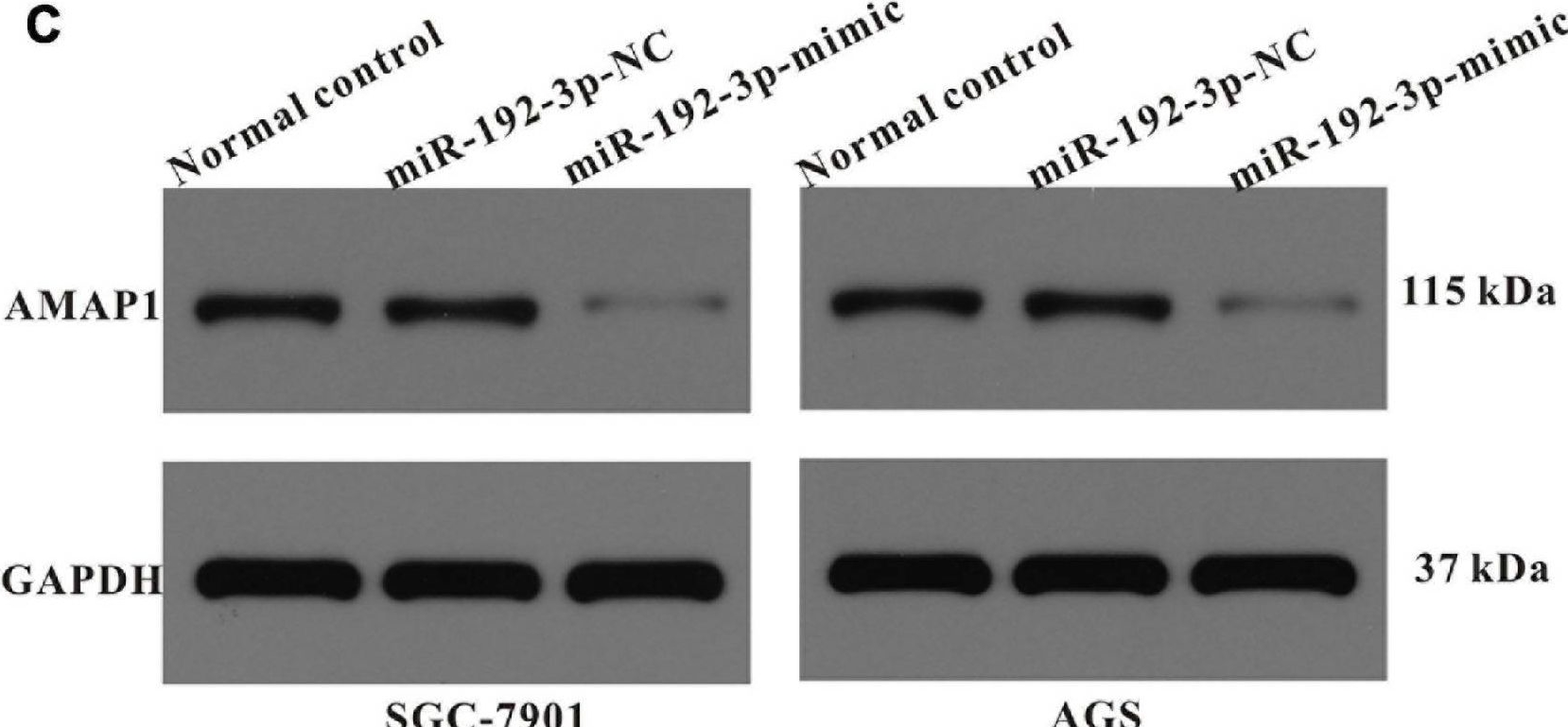 Fig.8.C showing Western Blotting in a Homo sapiens (Human) sample from the publication: Oncological Effects and Prognostic Value of AMAP1 in Gastric Cancer.