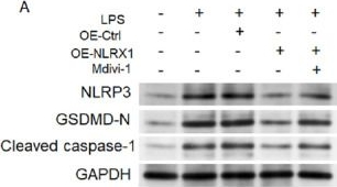 Fig.7.A showing Western Blotting in a Mus musculus (House mouse) sample from the publication: NLRX1 alleviates sepsis-induced acute lung injury by activating mitophagy and suppressing NLRP3 inflammasome activation.