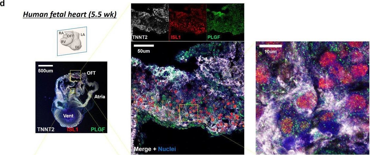 Fig.3.D showing Immunohistochemistry-immunofluorescence from the publication: Placental growth factor exerts a dual function for cardiomyogenesis and vasculogenesis during heart development.