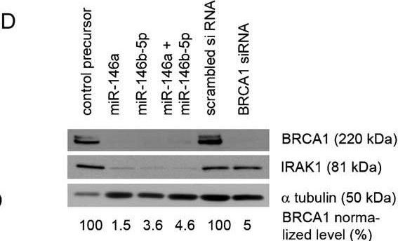 Fig.1.D showing Western Blotting in a Homo sapiens (Human) sample from the publication: Down-regulation of BRCA1 expression by miR-146a and miR-146b-5p in triple negative sporadic breast cancers.