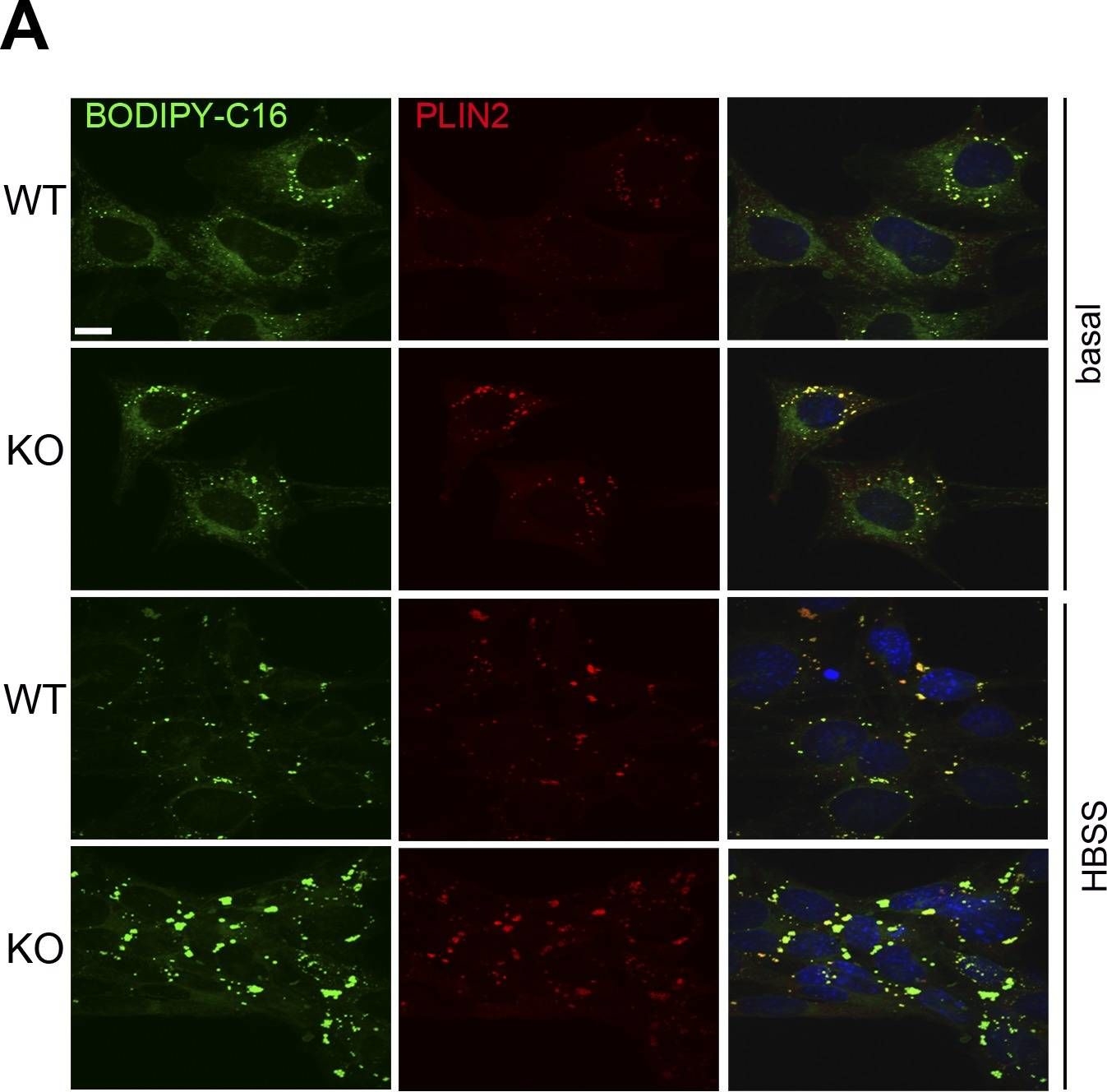 Microtubule-dependent and independent roles of spastin in lipid droplet dispersion and biogenesis.