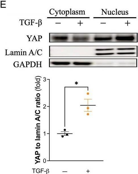 Fig.1.E showing Western Blotting from the publication: Depleting Yes-Associated Protein in Gli1-Expressing Cells Attenuates Peritoneal Dialysis-Induced Peritoneal Fibrosis.